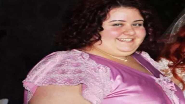 Aslı Samat Tüp Mide Ameliyatı Sonrası 108 Kilo Verdi