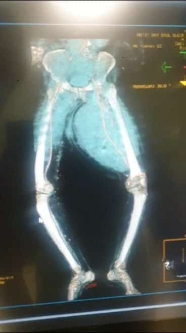 9-kilo-tumor-cikartildi1-min.jpg